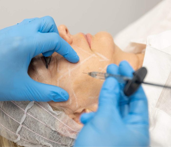 dr-aran-medicina-estetica-21 -